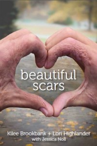 Beautiful Scars cover